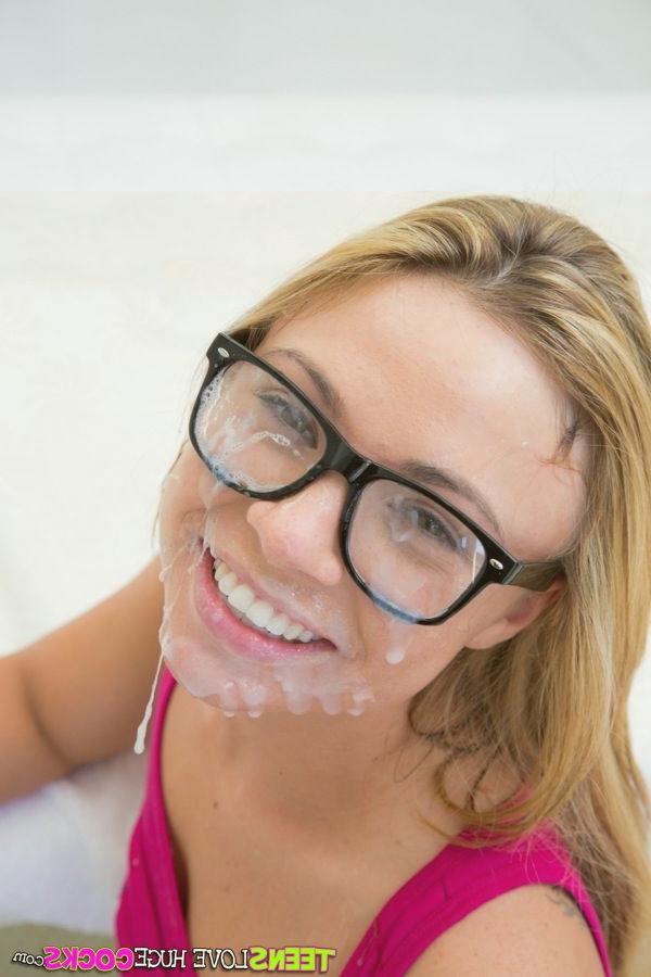 Katerina K, a beautiful girl wearing glasses, had her entire face burnt. Photo